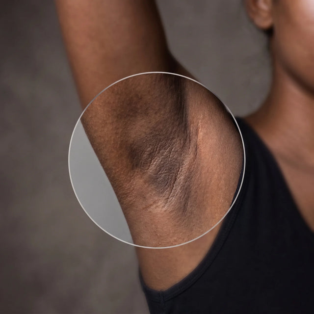 Why your skin